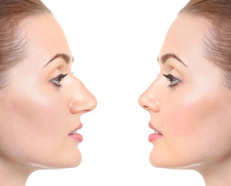 بعض العلاجات التي نوفرها 29 تجميل الانف في ايران