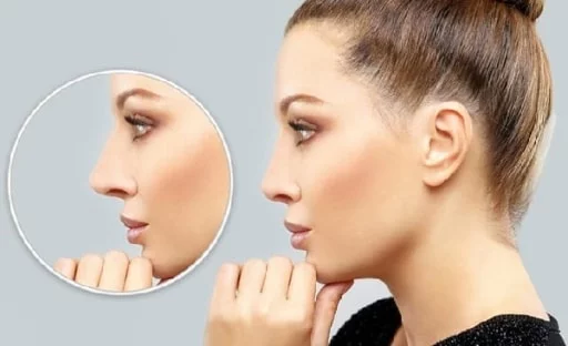 أربع نصائح لتجميل الانف تحتاجها قبل إجرائك لعملية الانف 1