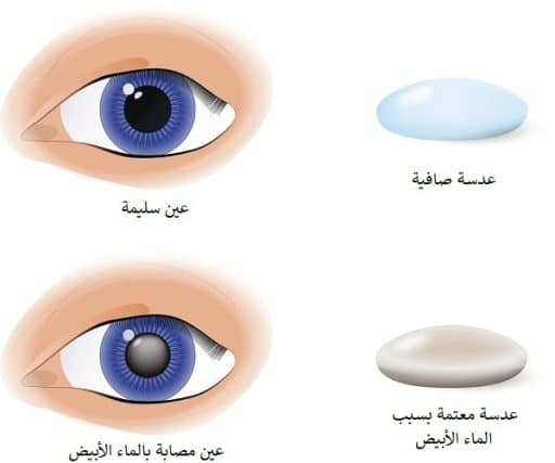 سحب الماء الابيض في ايران 6