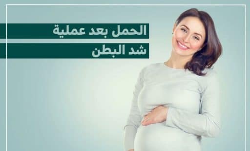 الحمل بعد شد البطن 1