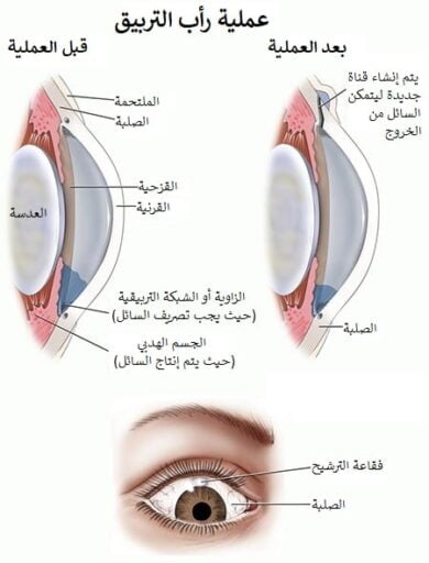 عملية الماء الأزرق في إيران 4 عملية الماء الأزرق في إيران 4