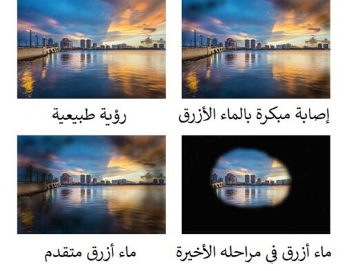 عملية الماء الأزرق في إيران 3 عملية الماء الأزرق في إيران 3