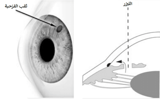 عملية الماء الأزرق في إيران 5 عملية الماء الأزرق في إيران 5