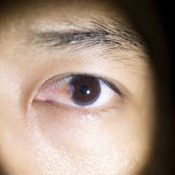 عملية ظفرة العين في ايران 1