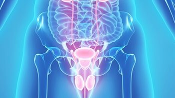 علاج سرطان المثانة في ايران