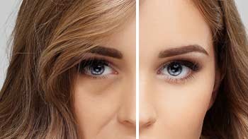 طب العيون في ايران | افضل دكتور ومستشفى ونتائج وتكلفة | سنا مدتور 11