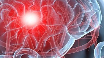 جراحة أورام الدماغ في ايران