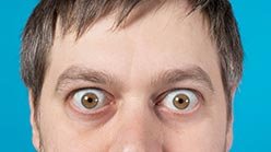 طب العيون في ايران | افضل دكتور ومستشفى ونتائج وتكلفة | سنا مدتور 14