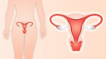 علاج سرطان عنق الرحم في ايران