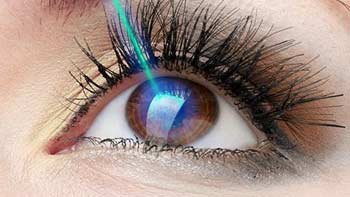 طب العيون في ايران | افضل دكتور ومستشفى ونتائج وتكلفة | سنا مدتور 9