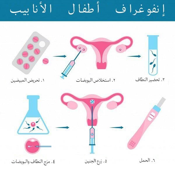 انفوغراف إنضاج البويضات في المختبر وأطفال الأنابيب