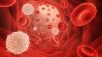 علاج سرطان الدم في ايران