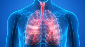 علاج سرطان الرئة في ايران