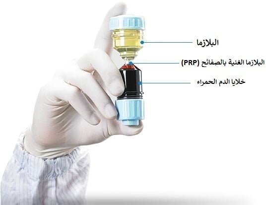 حقن البلازما في ايران | افضل دكتور تجميل ومستشفى وتكلفة | سنا مدتور 1 حقن البلازما في ايران