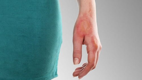 عمليات التجميل في ايران | افضل دكتور ومستشفى وتكلفة | سنا مدتور 38