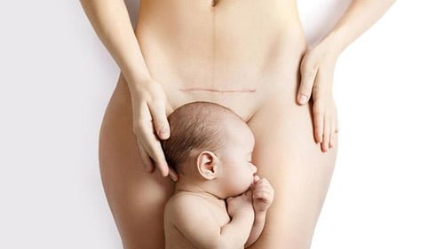 الجراحة العامة في ايران | أفضل جراحين ونتائج و أسعار | سنا مدتور 6