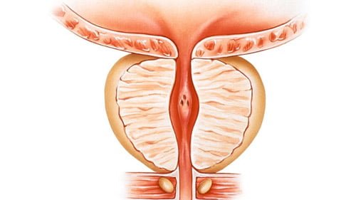 الجراحة العامة في ايران | أفضل جراحين ونتائج و أسعار | سنا مدتور 4