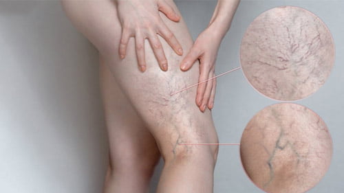 التجميل بدون جراحة في ايران | أفضل طبيب و مشفى و سعر | سنا مدتور 4 التجميل بدون جراحة في ايران | أفضل طبيب و مشفى و سعر | سنا مدتور 13