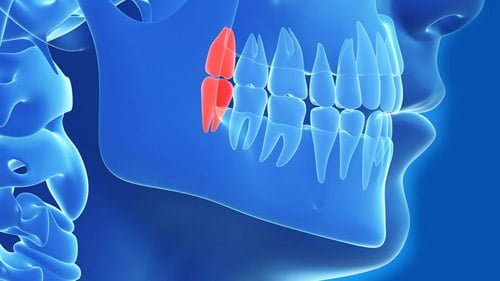طب الاسنان في ايران | أفضل عيادات اسنان ومواد وتكلفة | سنا مدتور 2