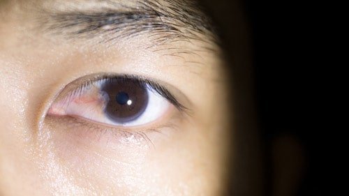 طب العيون في ايران | افضل دكتور ومستشفى ونتائج وتكلفة | سنا مدتور 15