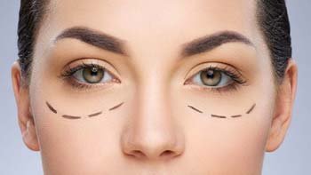 طب العيون في ايران | افضل دكتور ومستشفى ونتائج وتكلفة | سنا مدتور 20