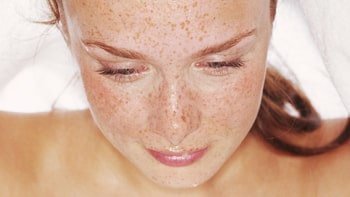 علاج سرطان الجلد في ايران