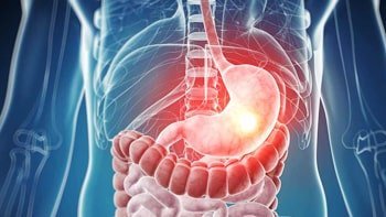 ربط المعدة في ايران بالمنظار | افضل طبيب ومشفى و سعر | سنا مدتور 1