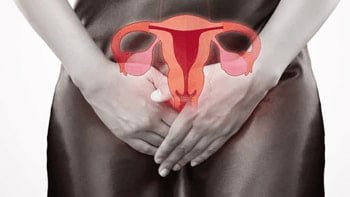 علاج سرطان المهبل في ايران