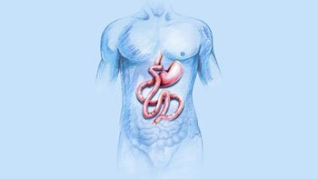 جراحة البطن في ايران