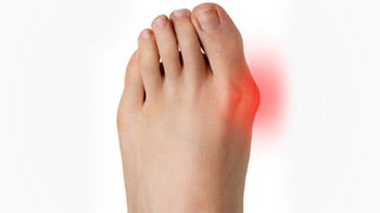 عملية ورم ابهام القدم في ايران عملية ورم ابهام القدم في ايران