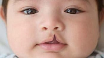 عمليات التجميل في ايران | افضل دكتور ومستشفى وتكلفة | سنا مدتور 13