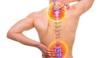 disc-hernia جراحة العظام والمفاصل في ايران | افضل دكتور وتكلفة | سنا مدتور 8