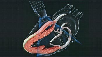 echo عملية القلب في ايران لدى أشهر الجراحين بأنسب الأسعار | سنا مدتور 10