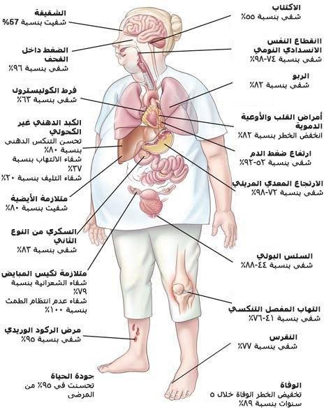 فوائد انقاص الوزن