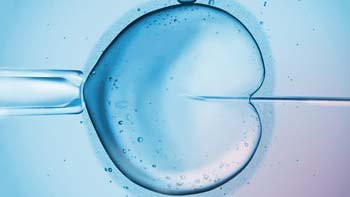 علاج العقم في ايران بأفضل نسب نجاح ومراكز وتكلفة | سنا مدتور 10