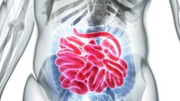 جراحة الامعاء الدقيقة في ايران