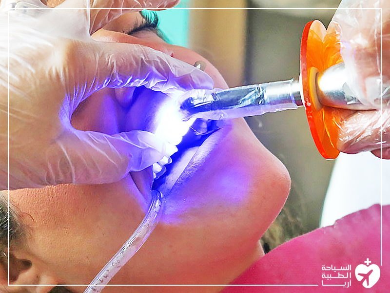 حشو الاسنان في ايران | أفضل حشوات وأطباء أسنان وتكلفة | سنا مدتور 1