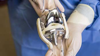 total-hip جراحة العظام والمفاصل في ايران | افضل دكتور وتكلفة | سنا مدتور 4