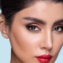 رفع الحواجب في ايران | افضل دكتور و مستشفى و تكلفة | سنا مدتور 1