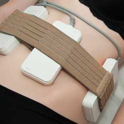 شفط الدهون بالليزر في ايران | افضل دكتور وعيادة وتكلفة 1 شفط الدهون بالليزر في ايران | افضل دكتور وعيادة وتكلفة 1