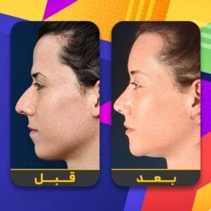 عملية انحراف الوتيرة في ايران | كل ما تحتاج معرفته عن عملية تصحيح انحراف الوتيرة 2