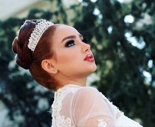 انواع الانف من وجهة نظر جراحة التجميل 9