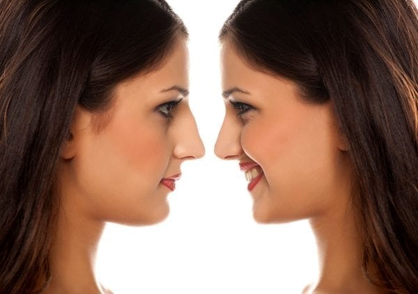 نصائح ما قبل عملية تجميل الانف 3 نصائح ما قبل عملية تجميل الانف 3