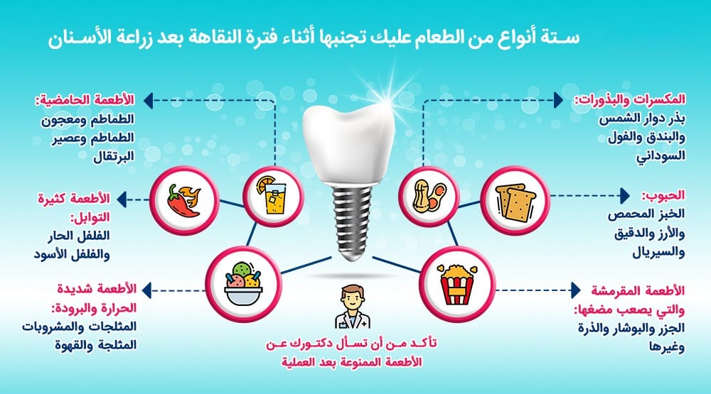 ما يجب تناوله وما يجب عدم تناوله من الطعام بعد زراعة الاسنان؟ 2 ما يجب تناوله وما يجب عدم تناوله من الطعام بعد زراعة الاسنان؟ 2