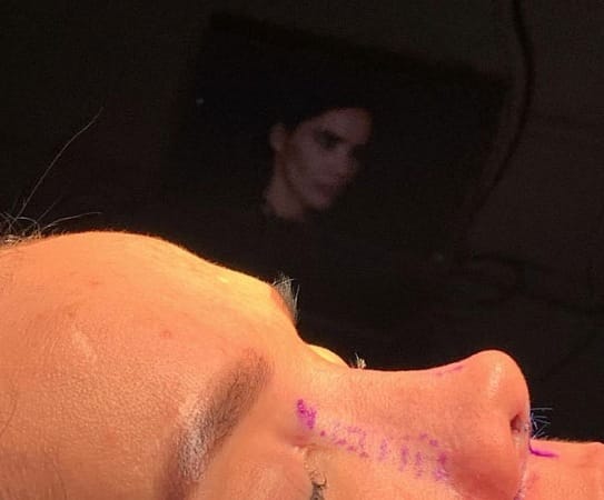 انواع الانف من وجهة نظر جراحة التجميل 1 انواع الانف من وجهة نظر جراحة التجميل 1