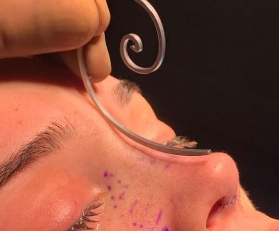 انواع الانف من وجهة نظر جراحة التجميل 5 انواع الانف من وجهة نظر جراحة التجميل 5