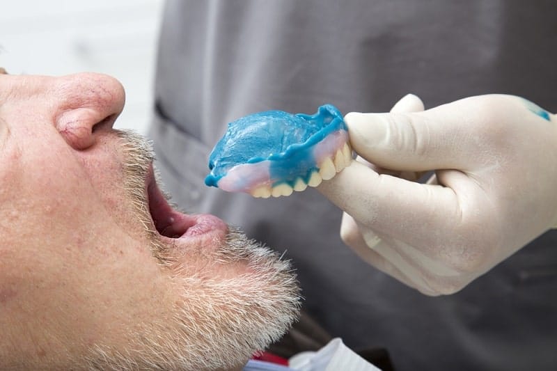 نصائح من أجل التعود على طقم الاسنان بشكل أسرع 2 نصائح من أجل التعود على طقم الاسنان بشكل أسرع 2