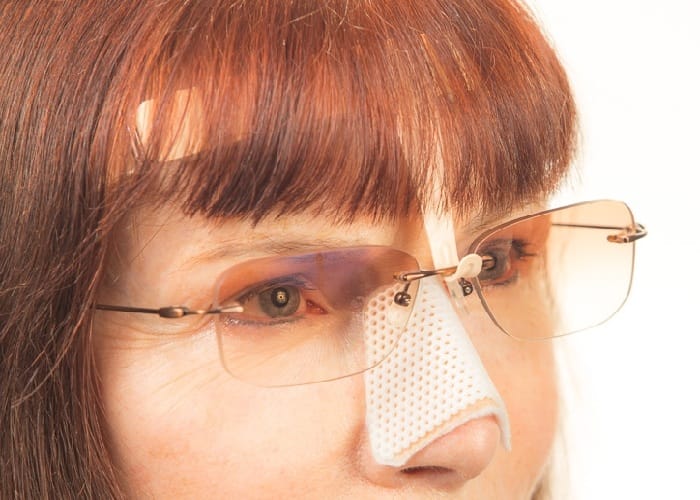 هل يمكنني لبس النظارة بعد عملية تجميل الانف؟ 2 هل يمكنني لبس النظارة بعد عملية تجميل الانف؟ 2