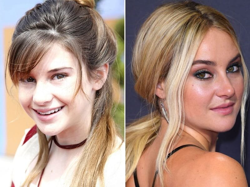 كيف يمكن التمييز إذا كان شخص ما قد أجرى عملية للأنف؟ 3