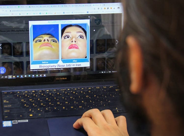 سبعة أشياء أساسية يجب التفكير بها قبل عملية التجميل 2 سبعة أشياء أساسية يجب التفكير بها قبل عملية التجميل 2